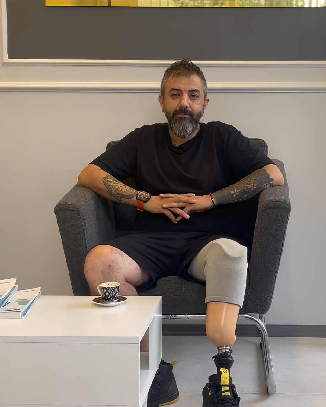 Protez Bacak Nedir? Hayatın Her Adımını YenidenAtmak