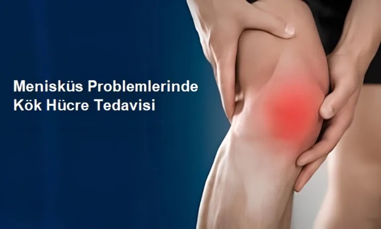 Kök Hücre ile Menisküs Problemleri Artık Ameliyatsız Tedavi Edilebiliyor!