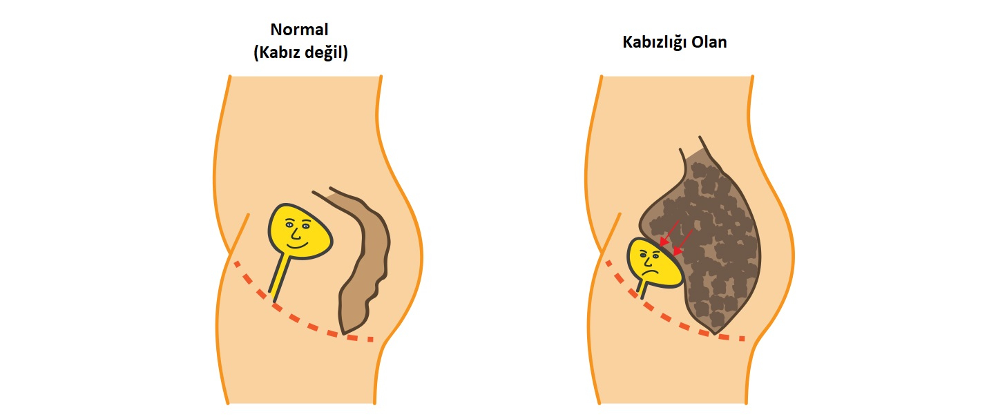 Çocuklarda Kabızlık Neden Olur? Beslenmede Nelere Dikkat Edilmeli?